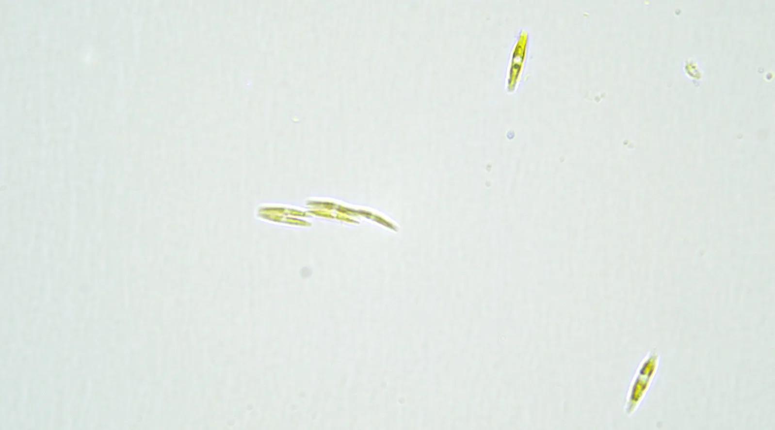 Miscroscope image of Pseudo-nitzschia subcurvata taken during the lab work